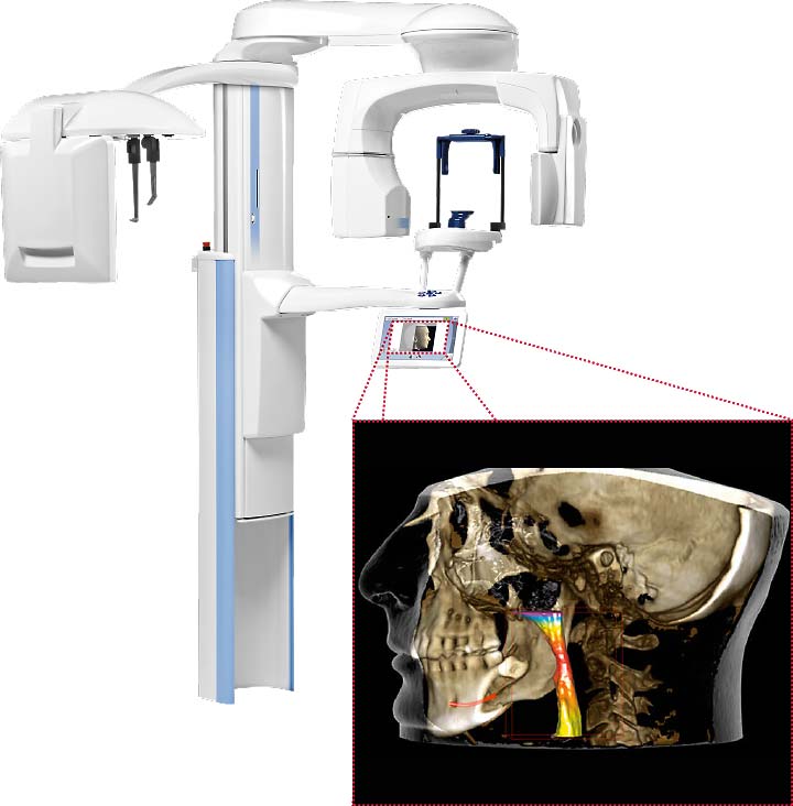 歯科用3D(立体)デジタルCT